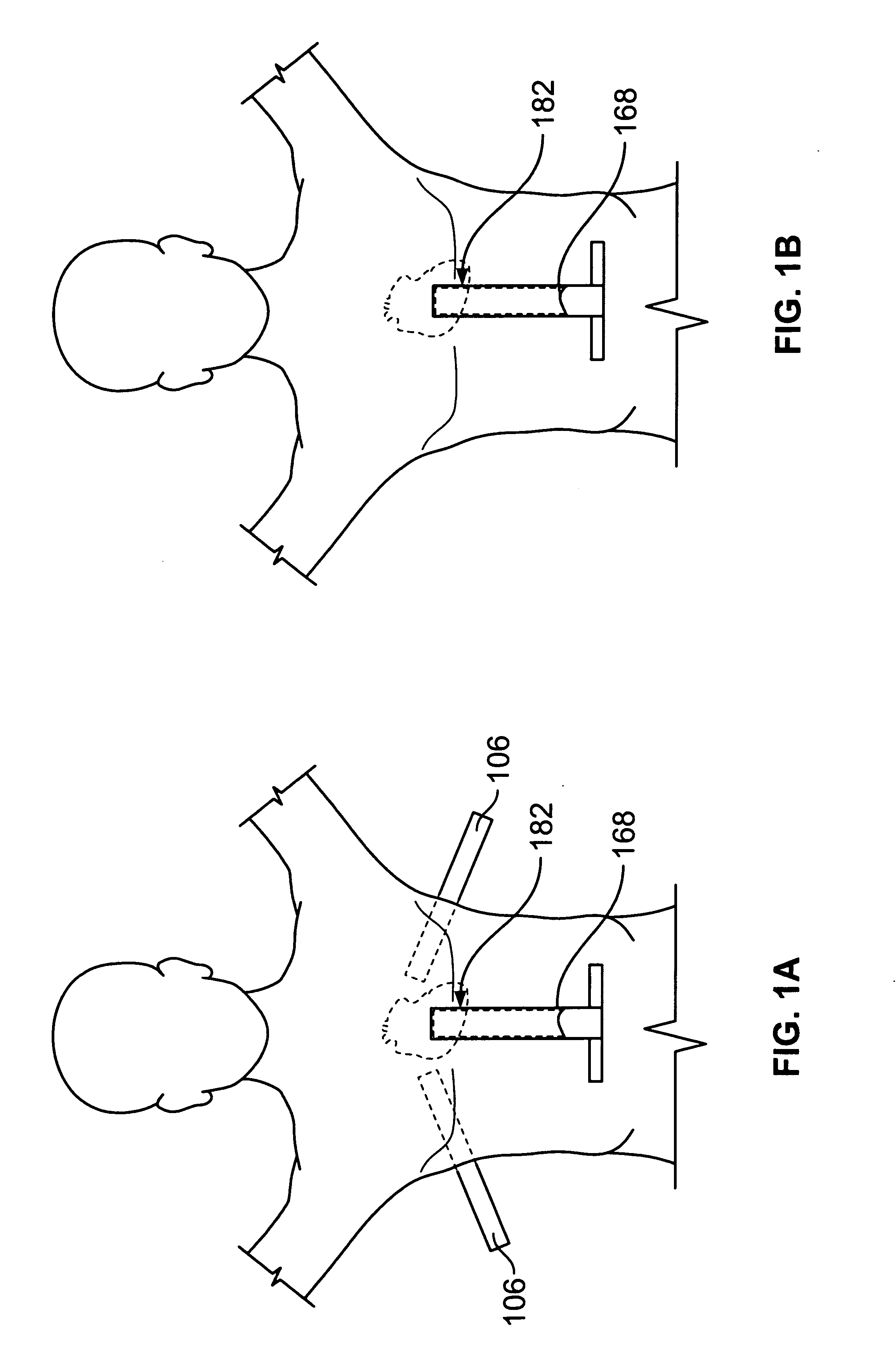 Diaphragm entry for posterior surgical access