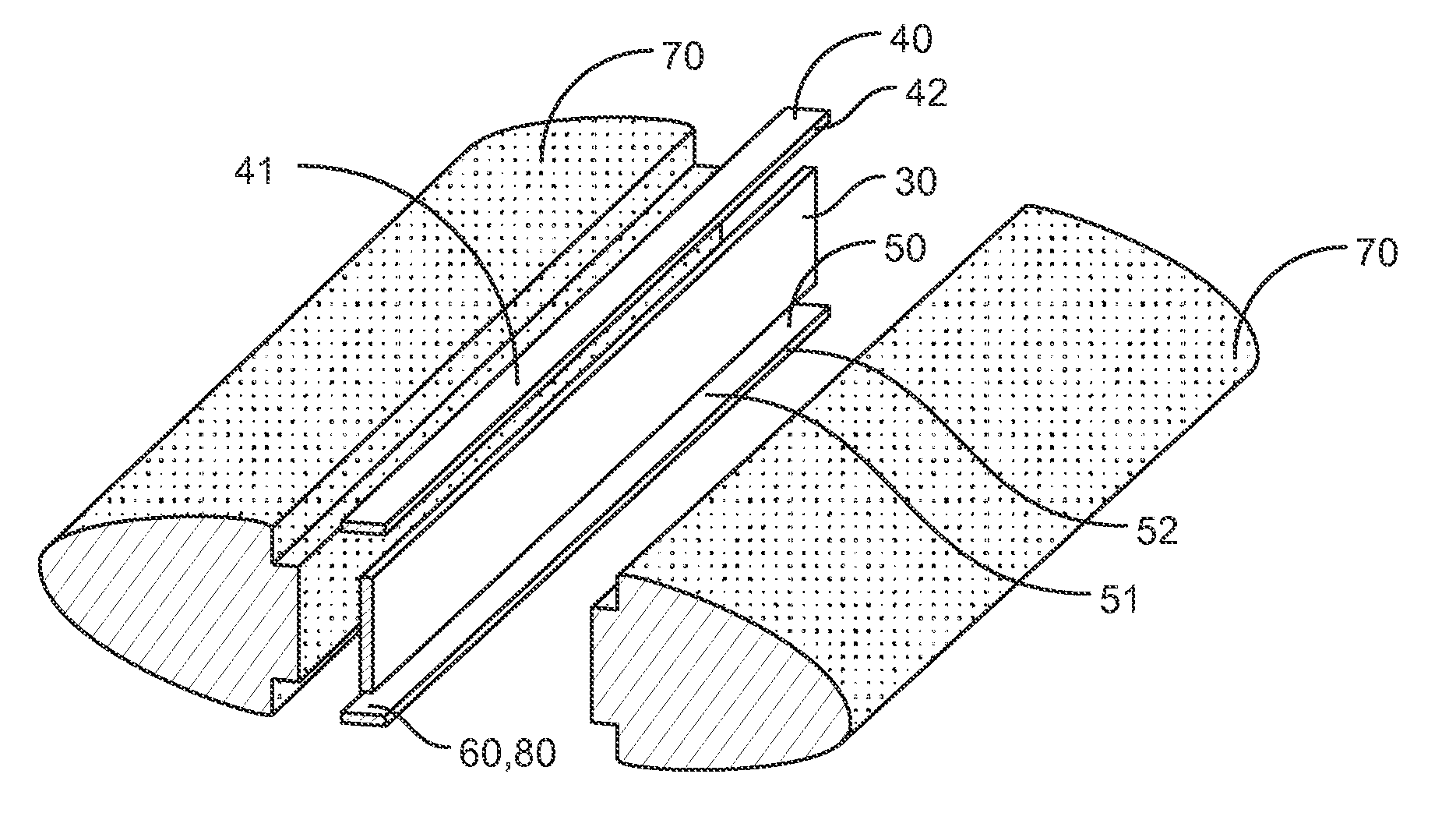 Surfboard Stringer Reinforcing system