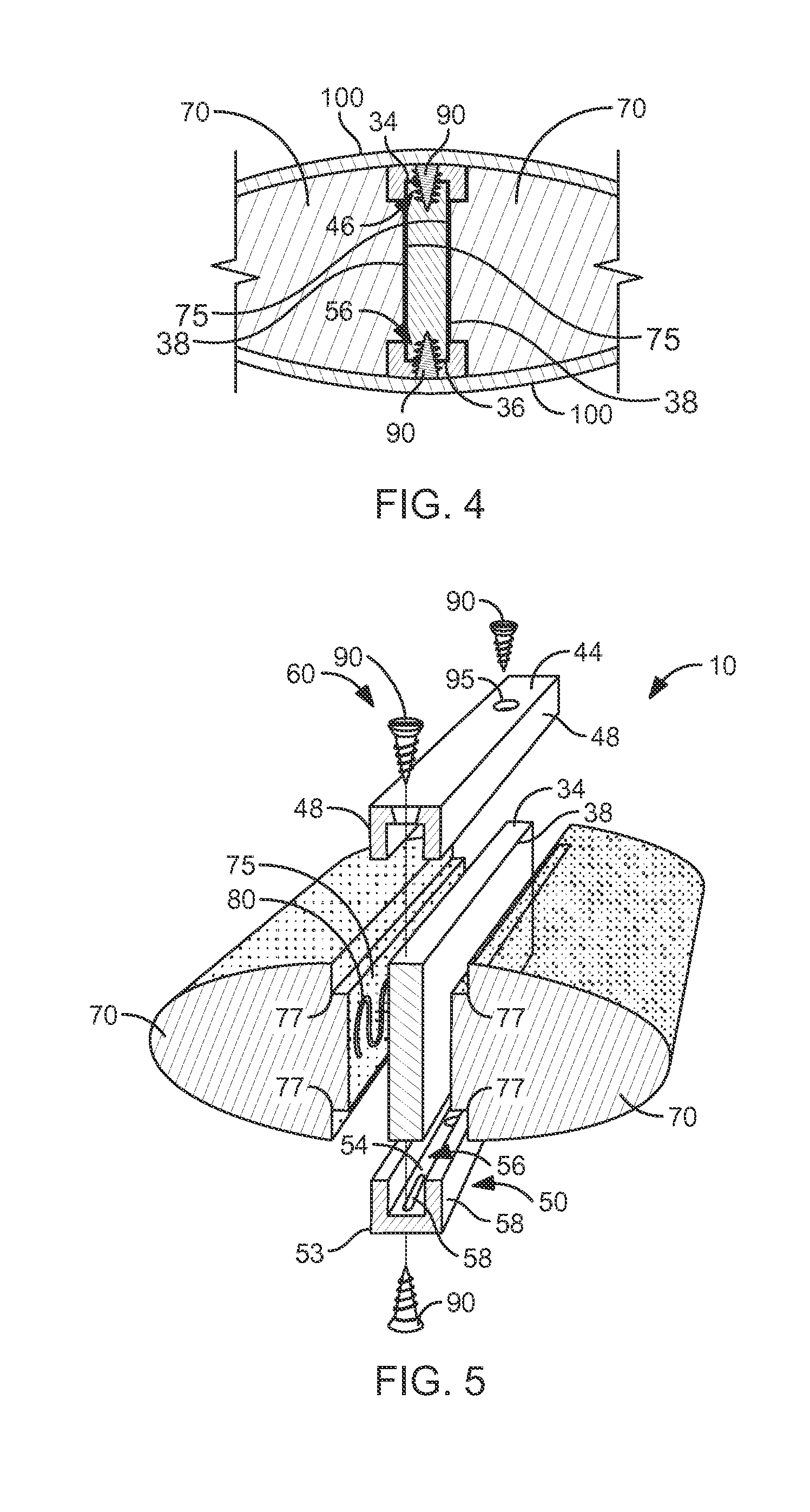 Surfboard Stringer Reinforcing system