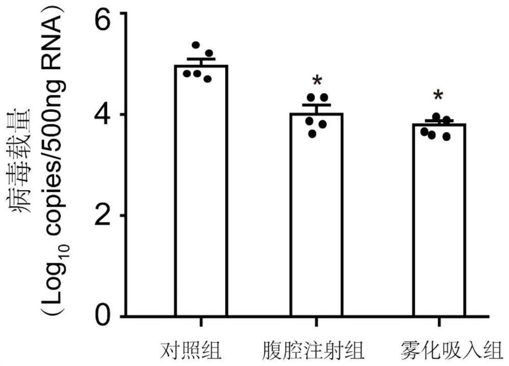 Application of pulsatilla saponin B4 in preparation of medicine for treating or preventing SARS-CoV-2