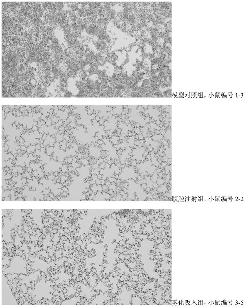 Application of pulsatilla saponin B4 in preparation of medicine for treating or preventing SARS-CoV-2