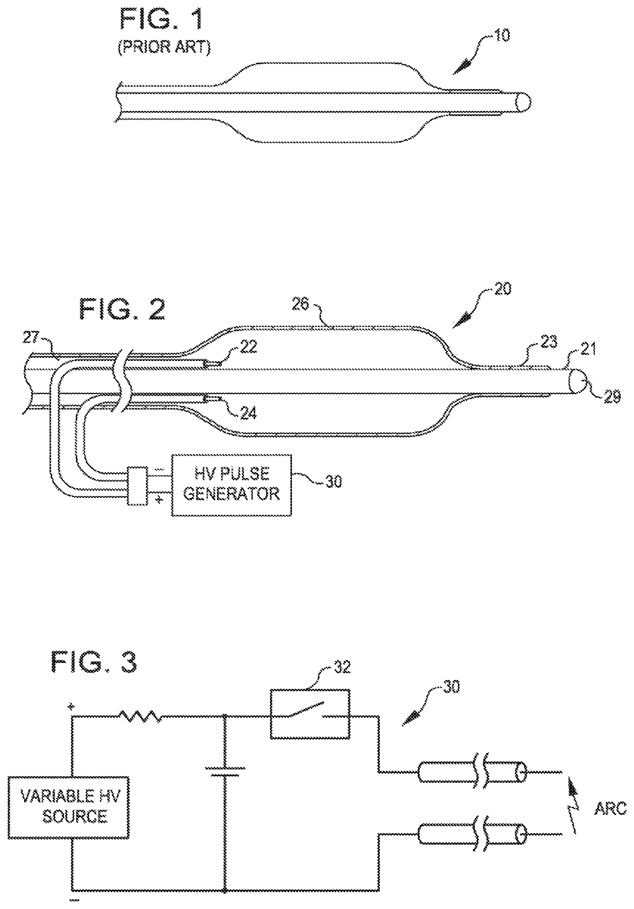 Two-stage method for treating calcified lesions within the wall of a blood vessel