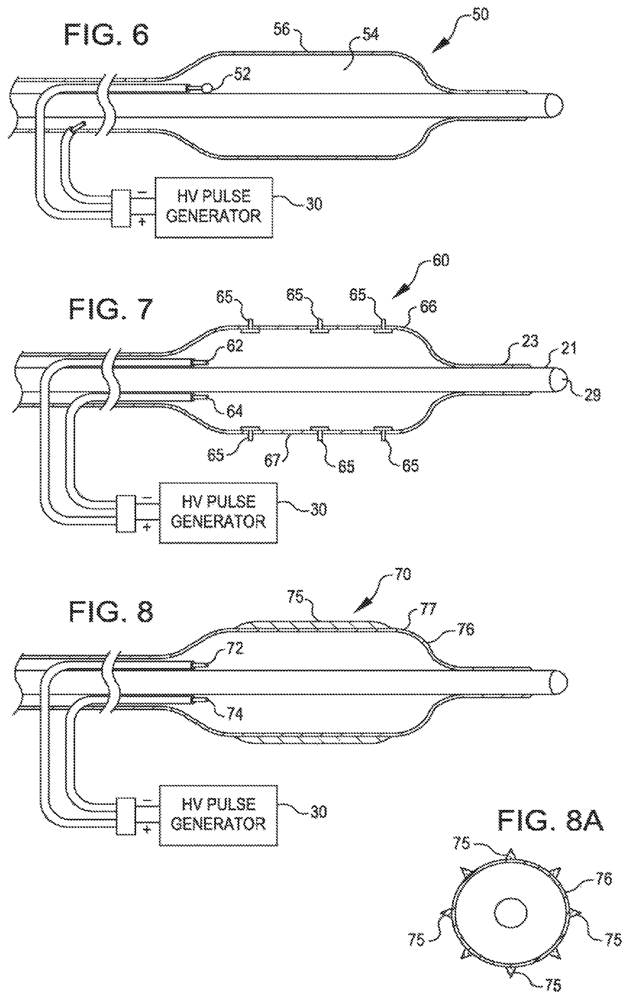 Two-stage method for treating calcified lesions within the wall of a blood vessel