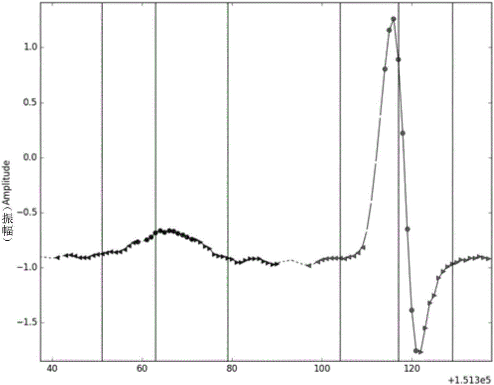 Electrocardiosignal feature point detecting method and device