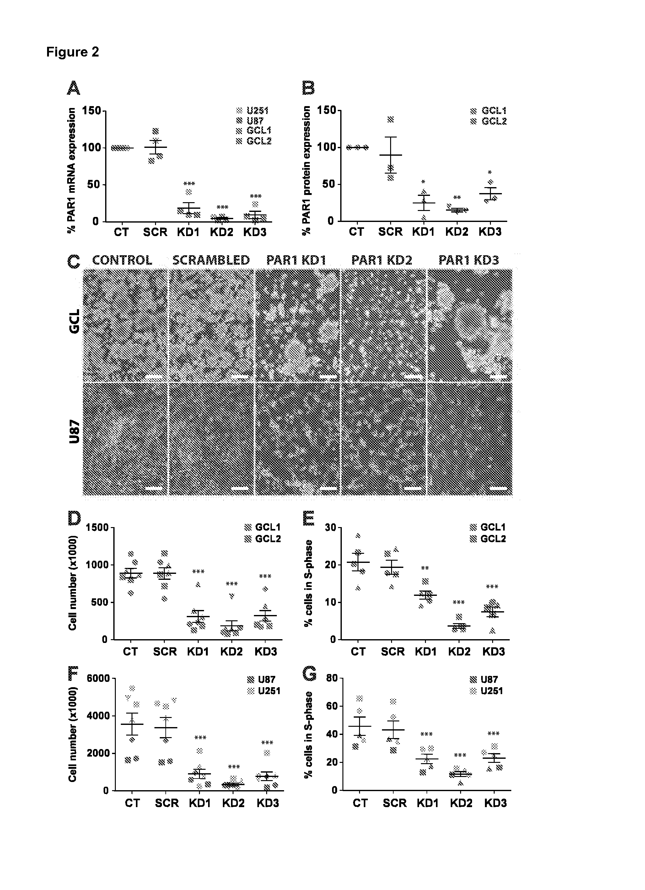 Use of inhibitors of binding between a par-1 receptor and its ligands for the treatment of glioma