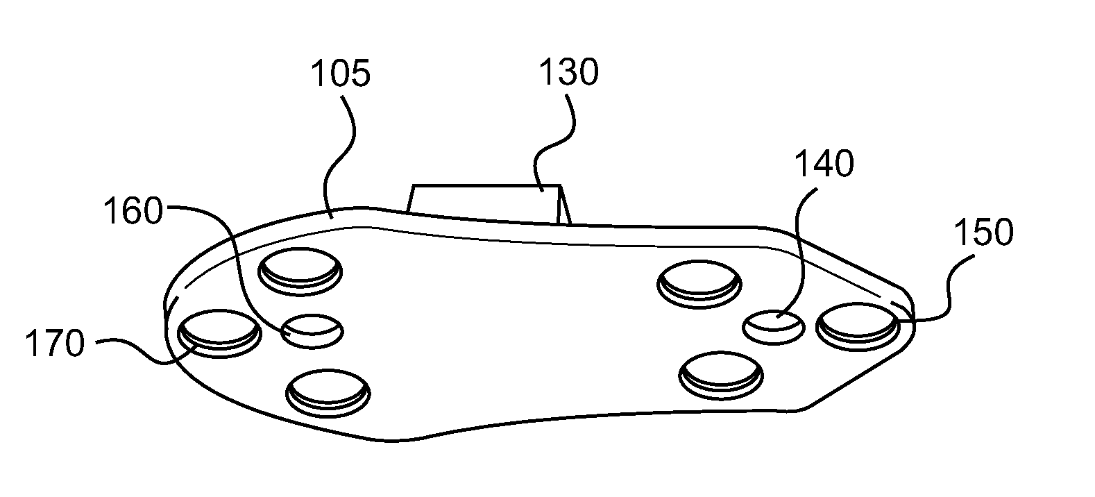 Implant for correcting skeletal mechanics