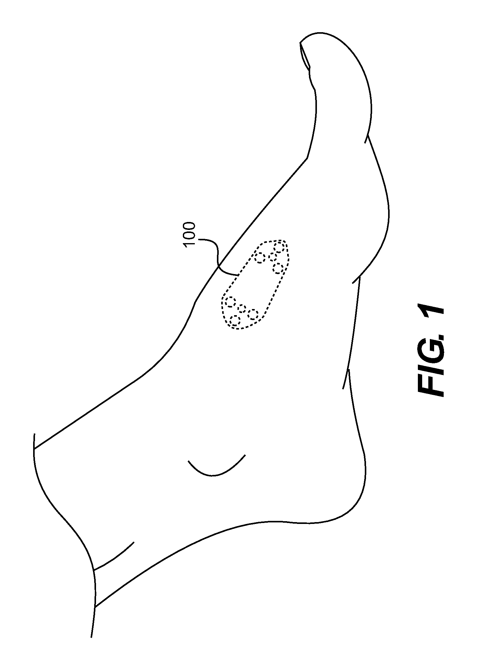 Implant for correcting skeletal mechanics