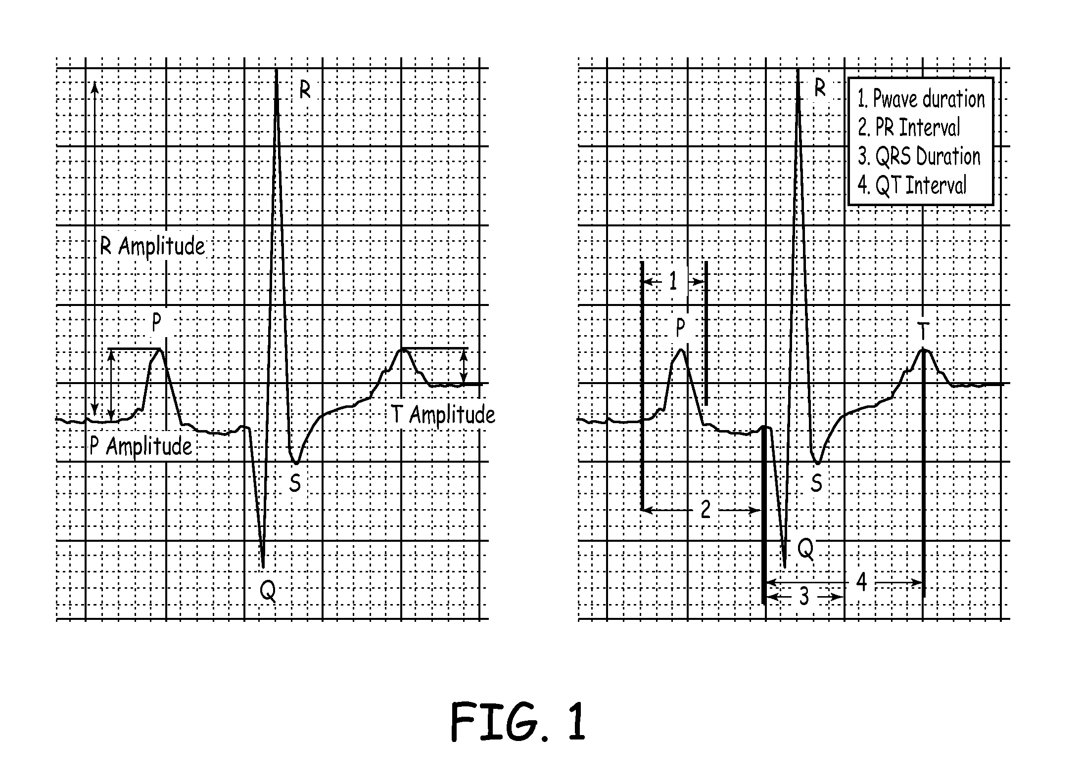 Apparatus and methods of optimizing atrioventricular pacing delay intervals