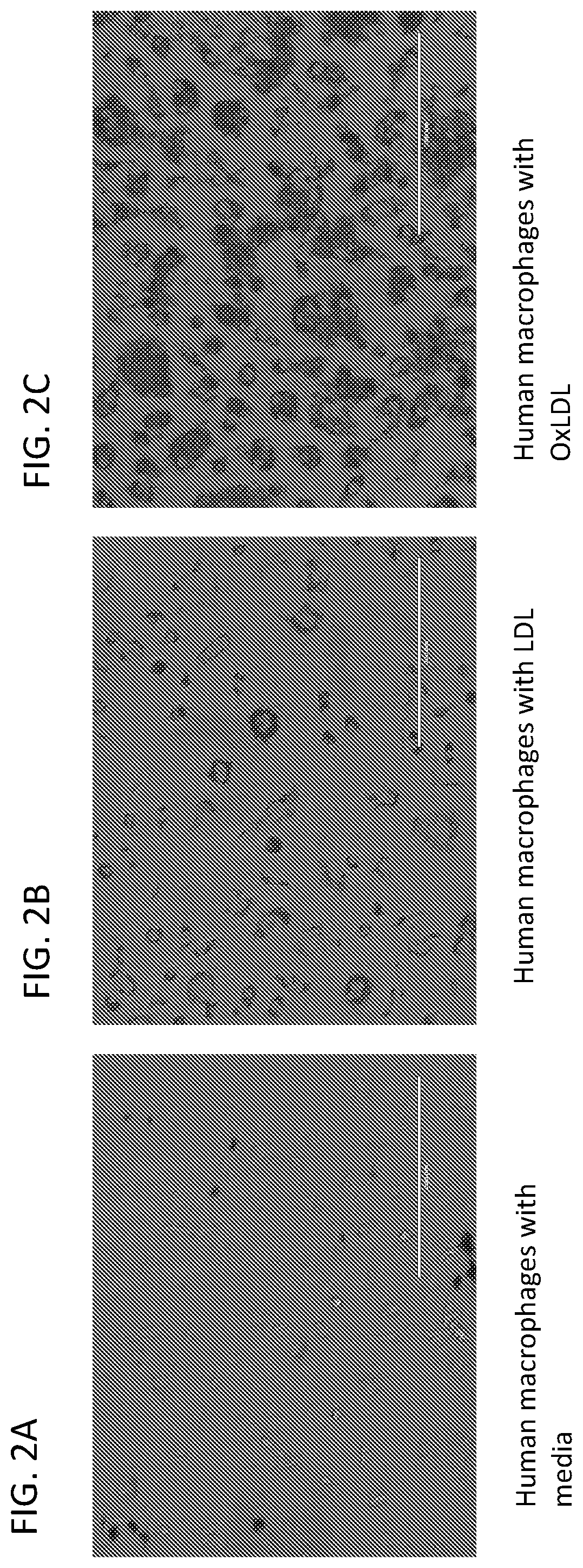 Chimeric Antigen Receptor T Regulatory Cells for the Treatment of Atherosclerosis