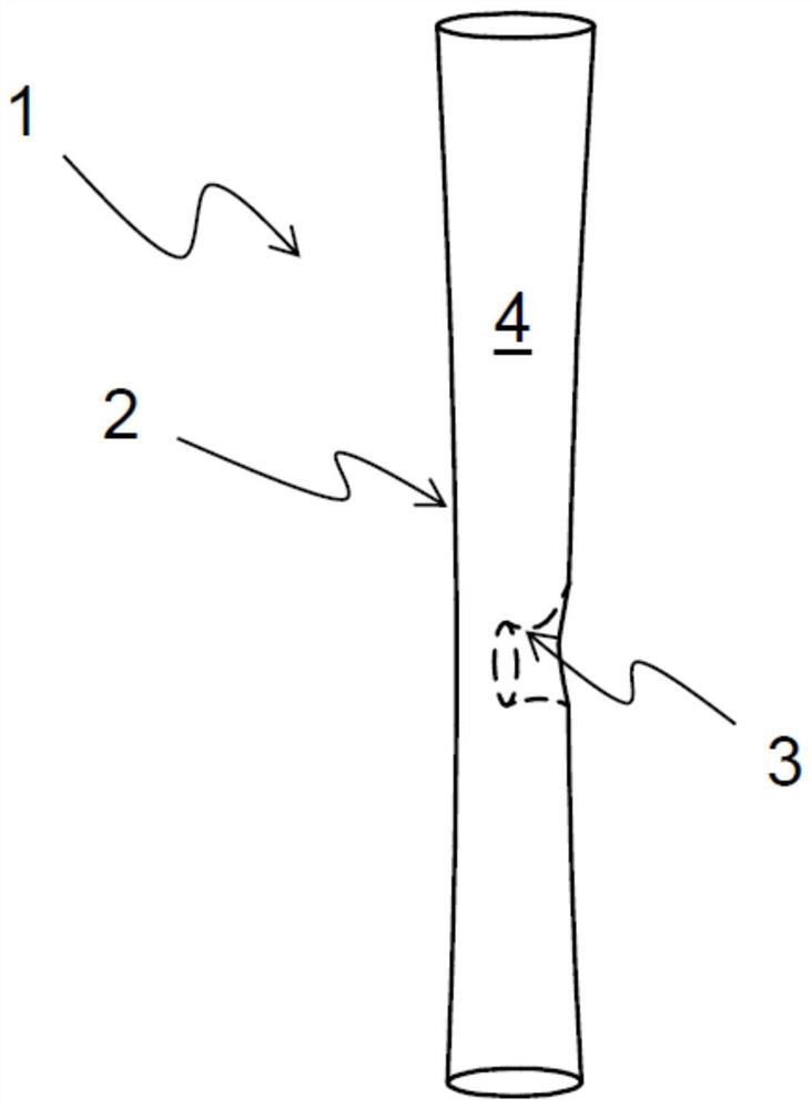 Bifurcated stent and stent system