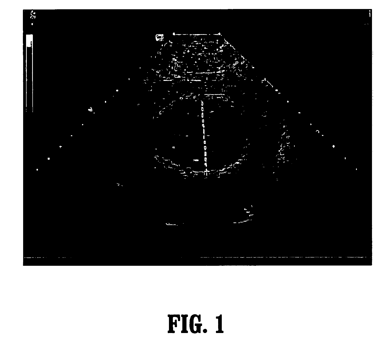 System and method for fetal biometric measurements from ultrasound data and fusion of same for estimation of fetal gestational age