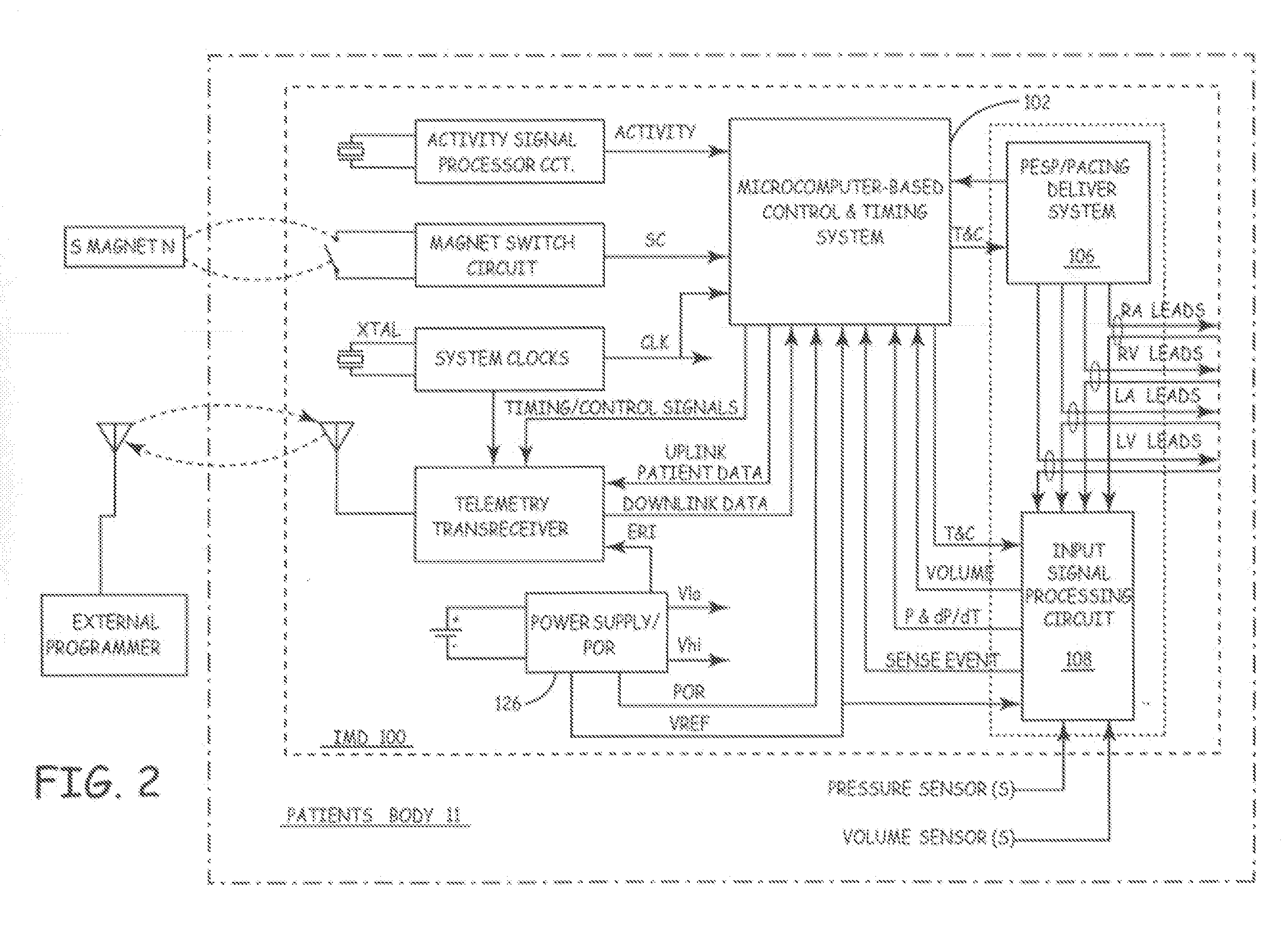 Method, Apparatus and System to Identify Optimal Pacing Parameters Using Sensor Data