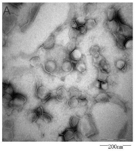 Vincristine sulfate liposome and its preparation method and application