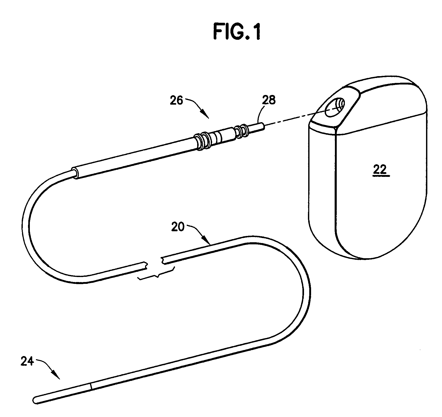 Packaging sensors for long term implant