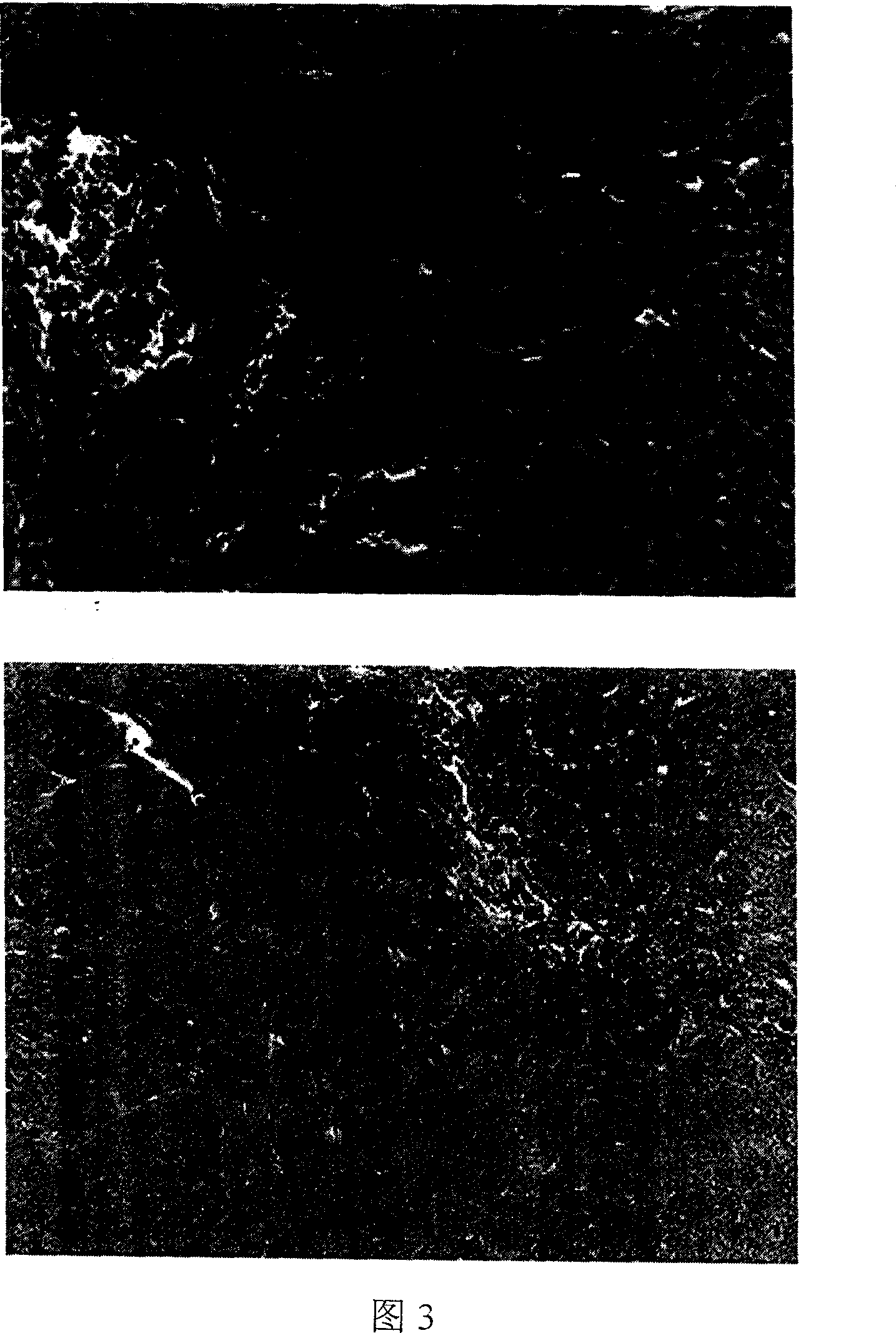 Genetic medicine for preventing and treating cancer of colon and rectum, preparation process and use thereof