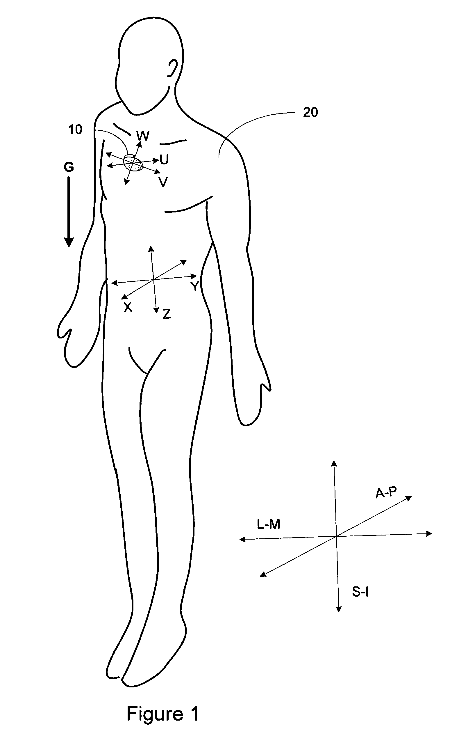 Posture detector calibration and use