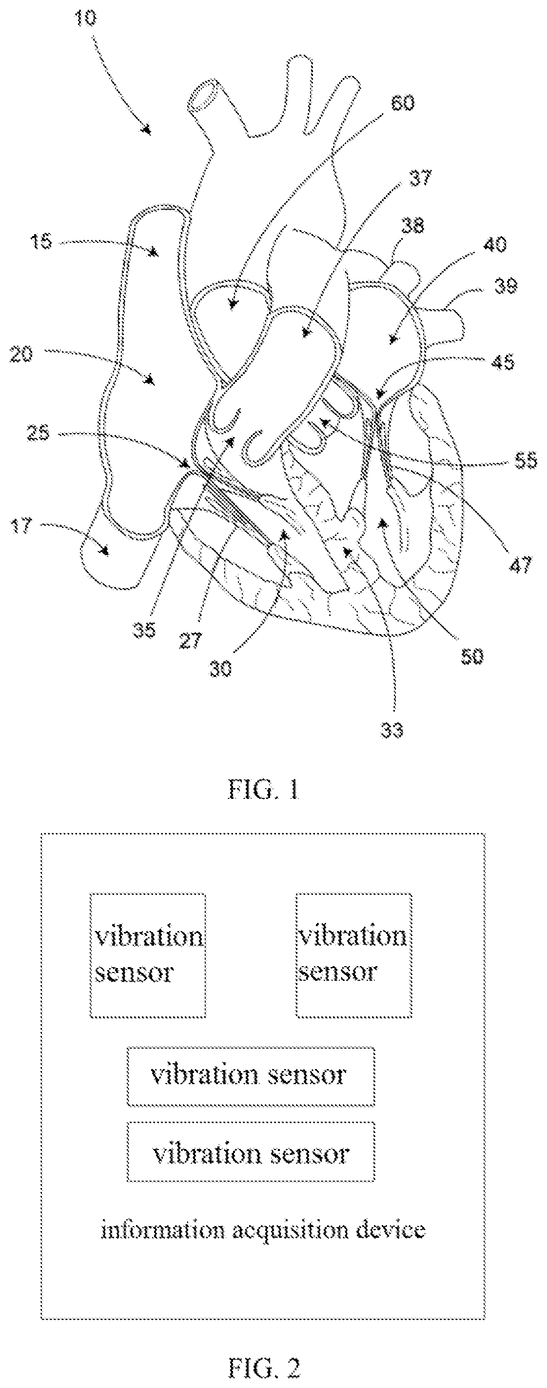 Heart physiological parameter measurement method, device and terminal, and computer storage medium