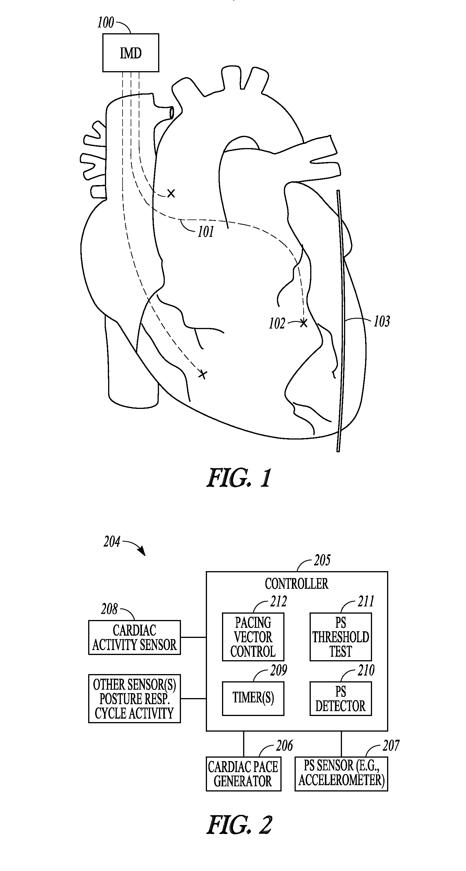 Baseline determination for phrenic nerve stimulation detection