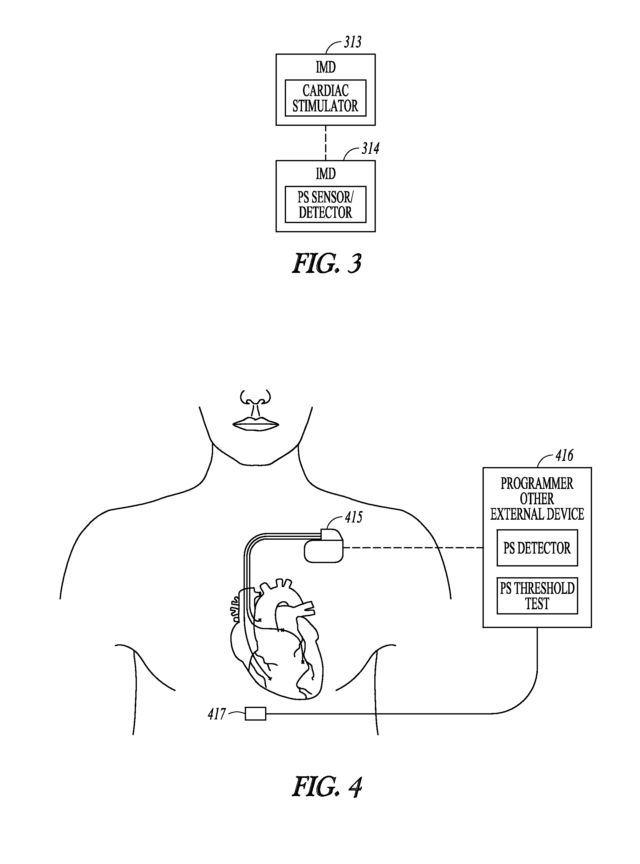 Baseline determination for phrenic nerve stimulation detection