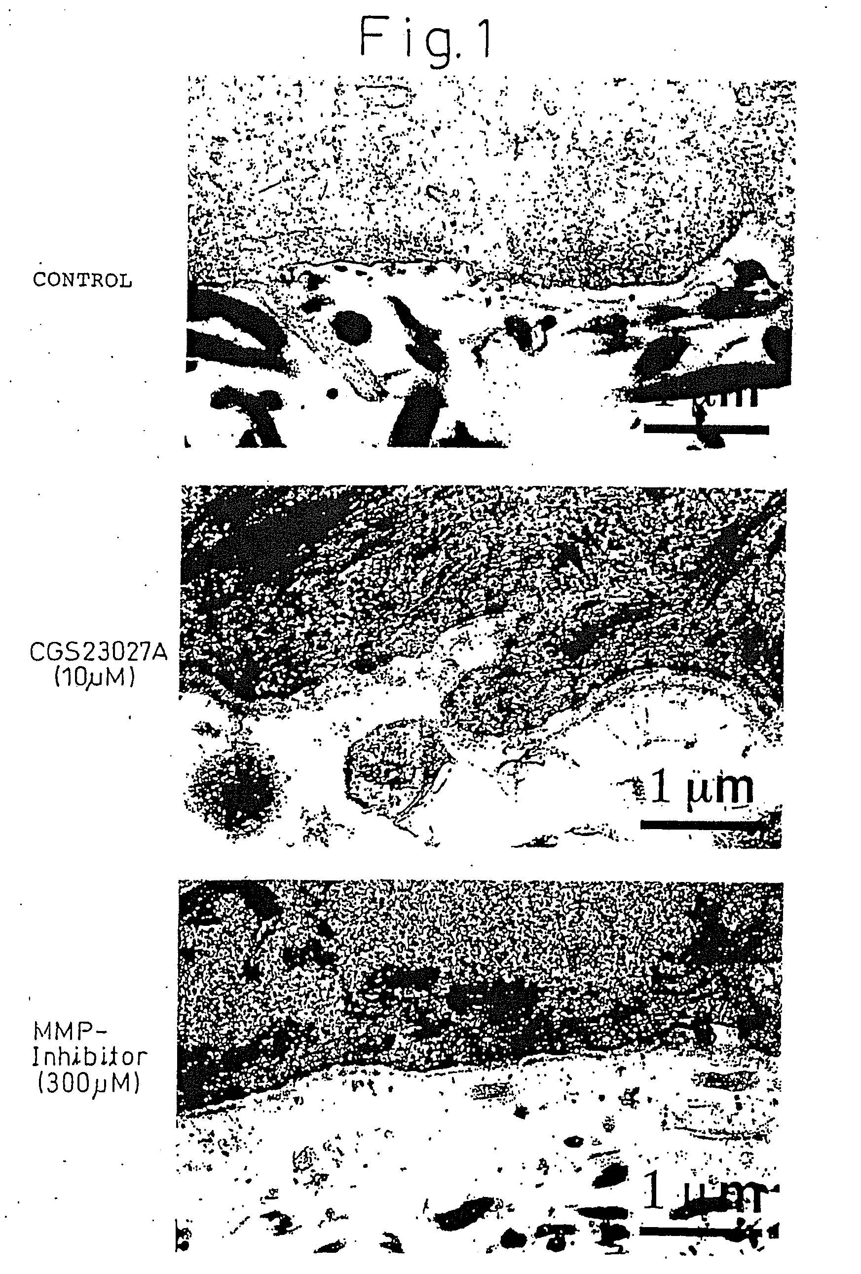 Method of Production of Artificial Skin