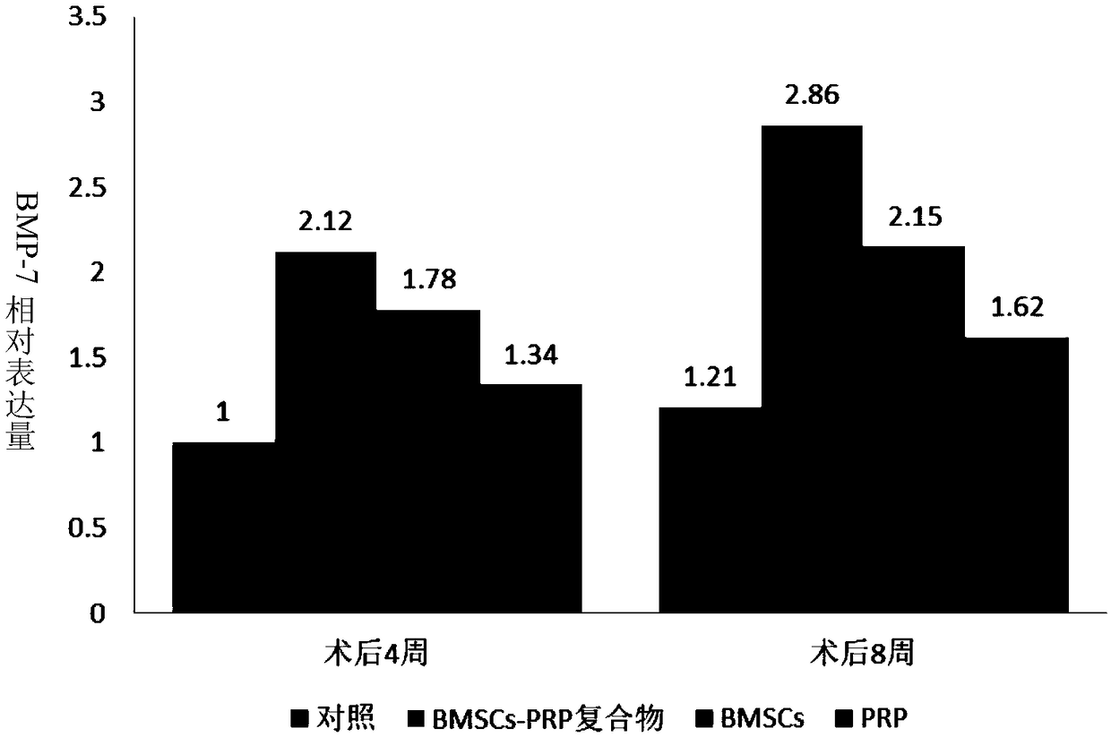 Application of mesenchymal stem cells combined with platelet-rich plasma in preparation of medicine for promoting rotator cuff injury tendon-bone complex concrescence