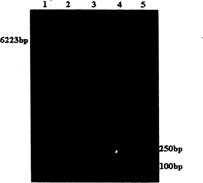 Mouse beta-alexin 1 recombinant plasmids, polypeptides, uses and preparations thereof