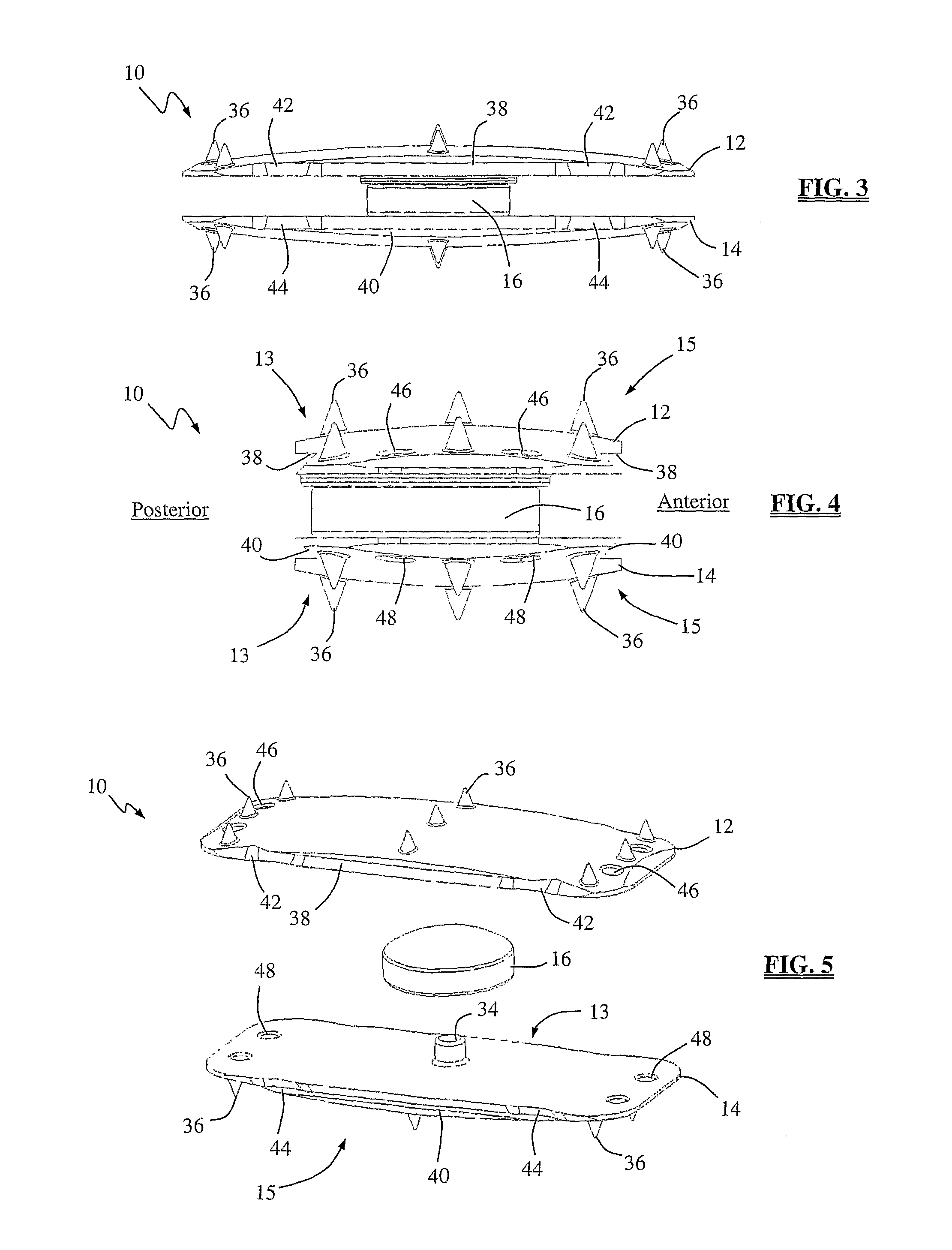 Total disc replacement system and related methods