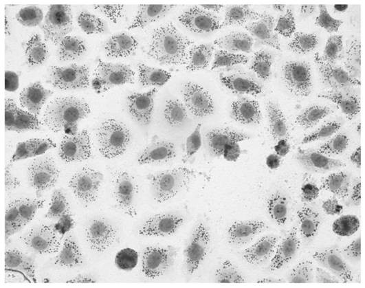 A clam enzymatic oligopeptide capable of repairing non-alcoholic fatty liver disease cell model and its preparation method