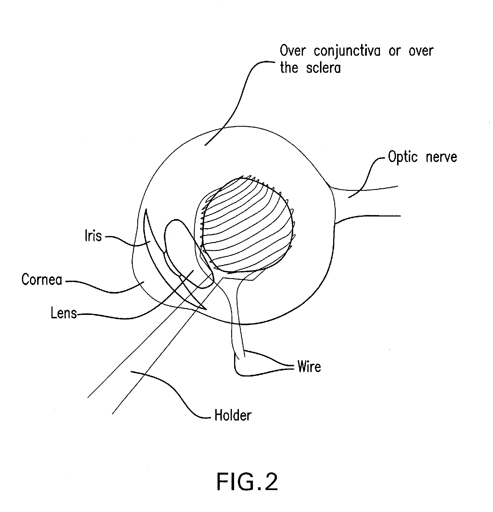 Method and composition for hyperthermally treating cells