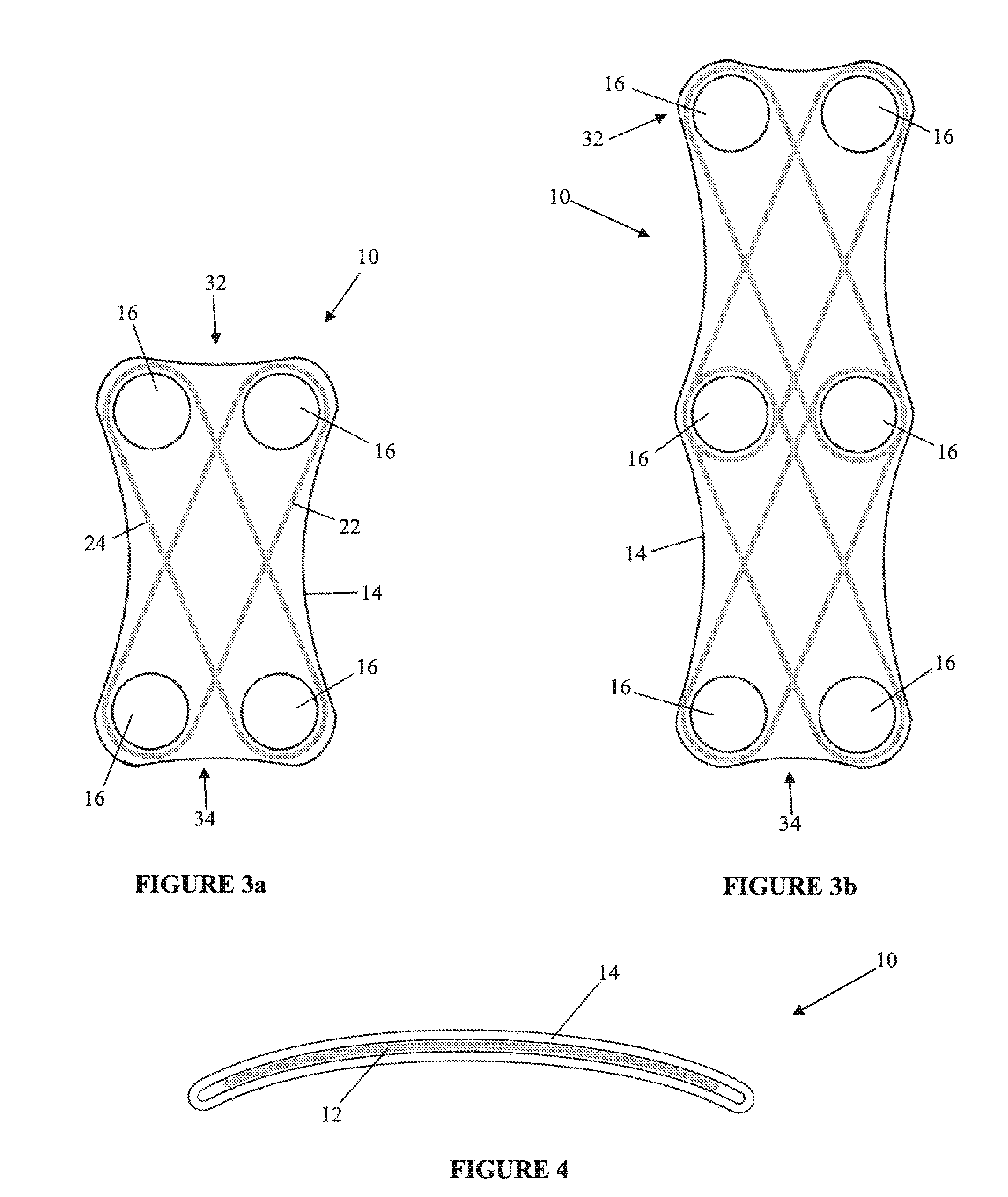 3-dimensional embroidery structures via tension shaping