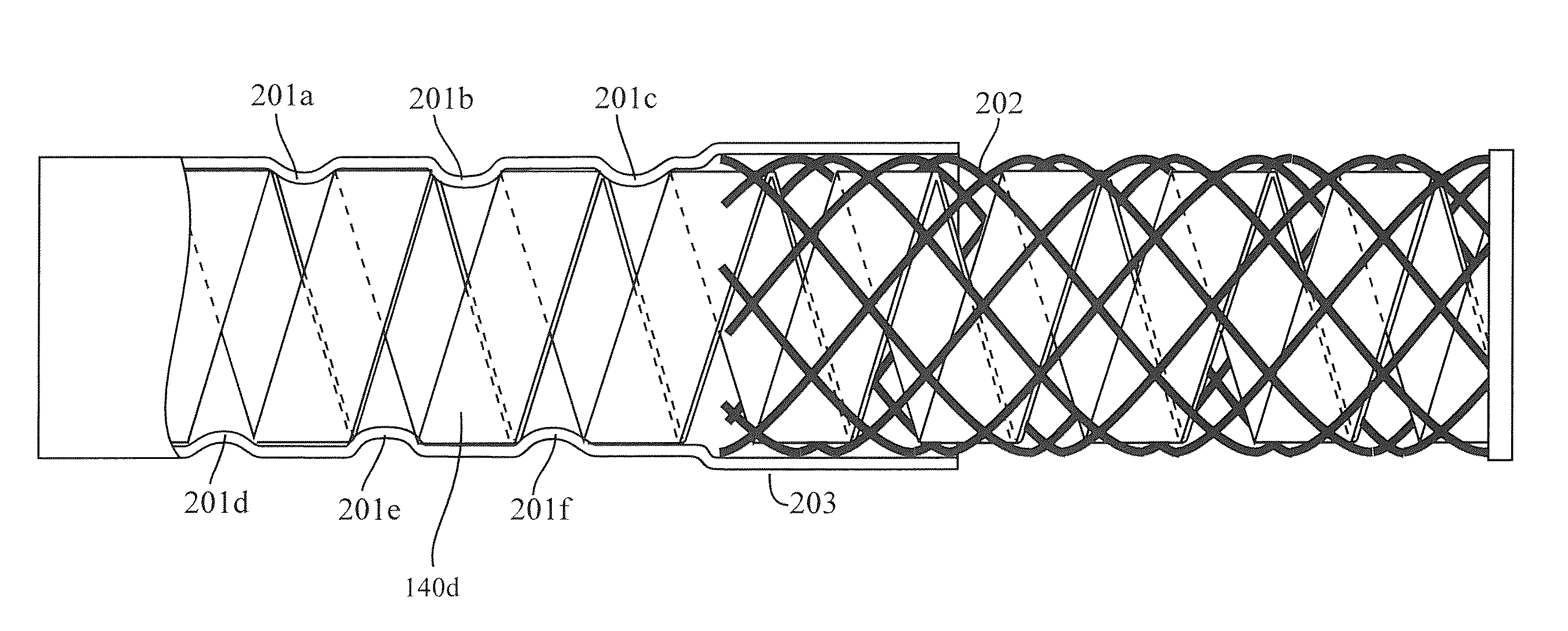 Catheter and method of making the same