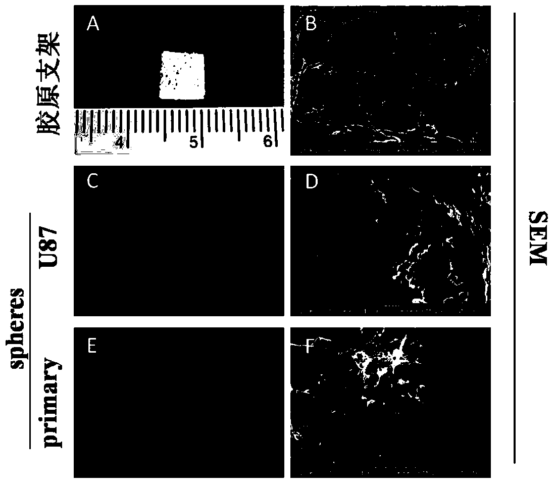 A three-dimensional culture model and application of glioma stem cells in vitro