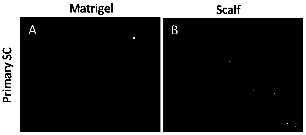 A three-dimensional culture model and application of glioma stem cells in vitro