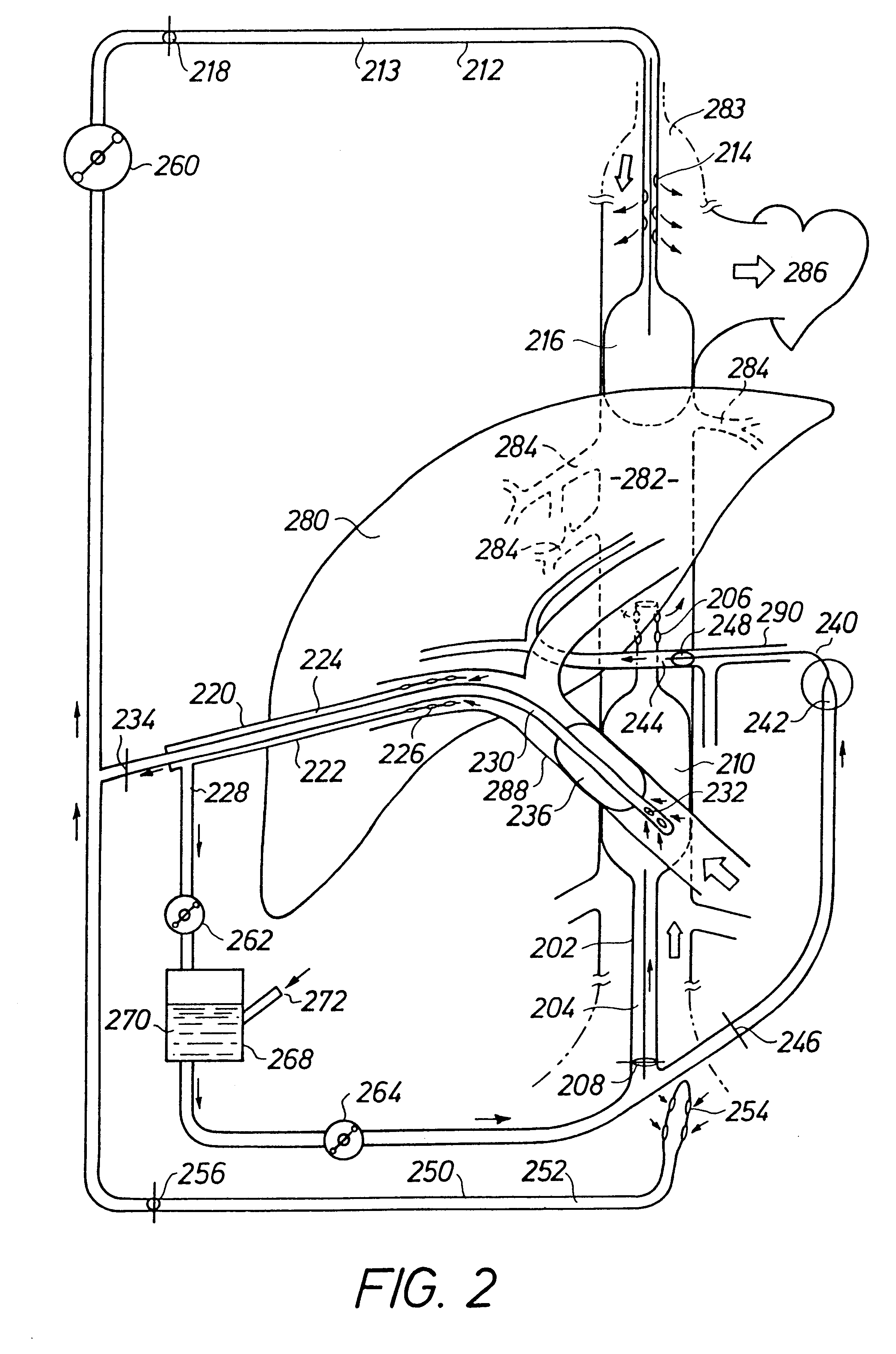 Perfusion system