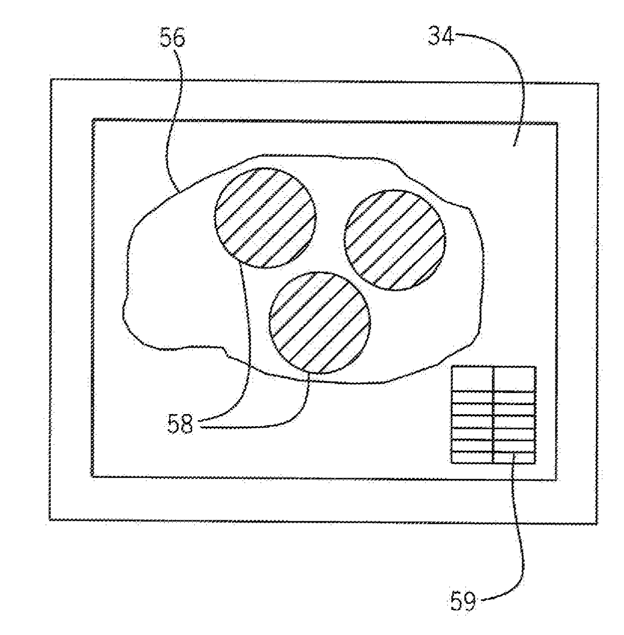 System for Characterizing Brain Condition