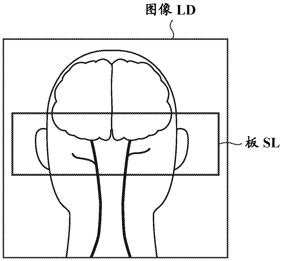 Magnetic resonance equipment