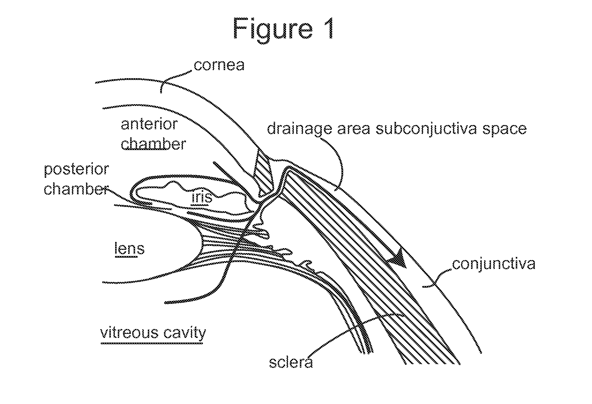 Subconjunctival conformer device and uses thereof