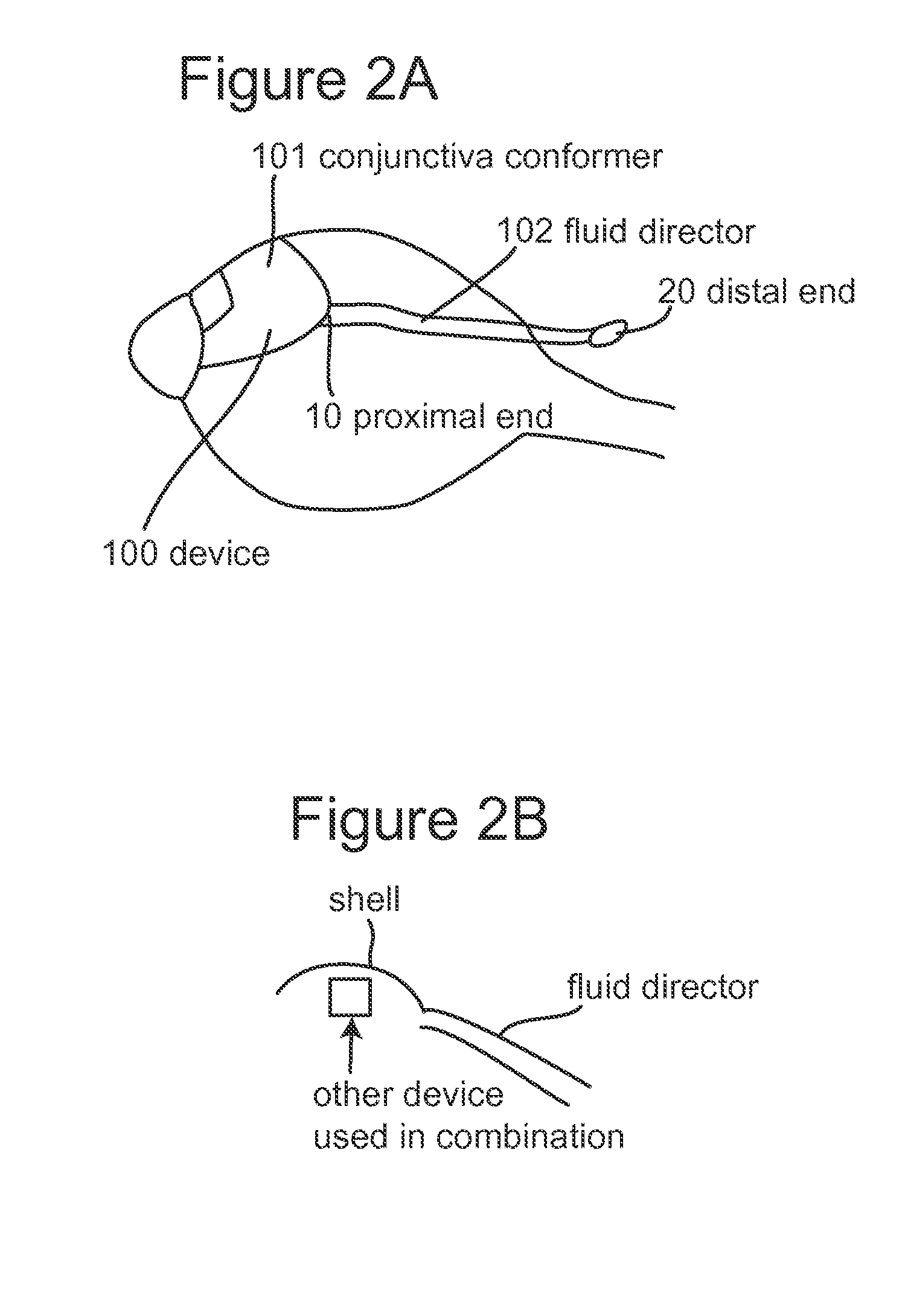 Subconjunctival conformer device and uses thereof