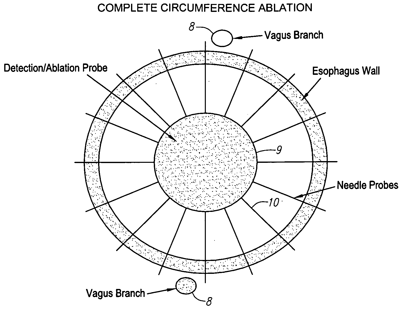 Methods and apparatus for treatment of obesity with an ultrasound device movable in two or three axes