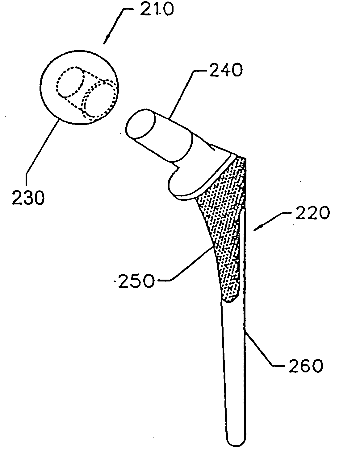 Implant with composite coating