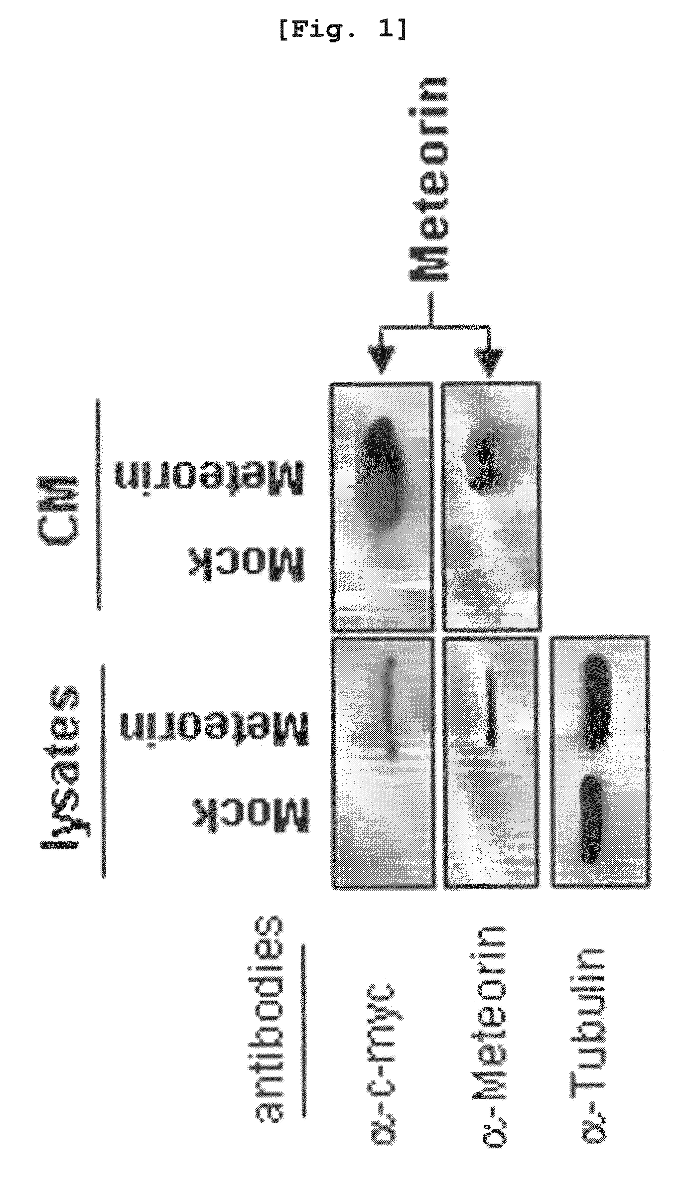 Angiogenesis inhibitor comprising meteorin as an active ingredient