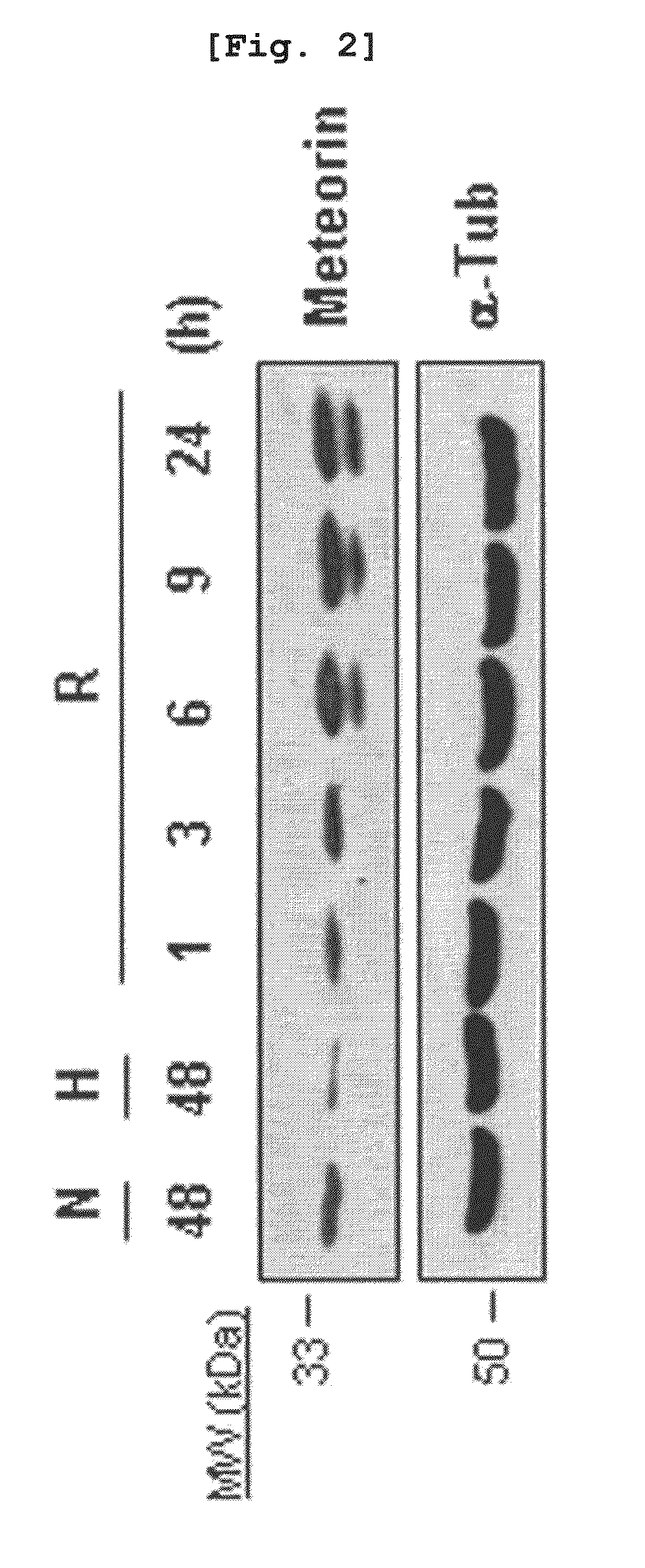 Angiogenesis inhibitor comprising meteorin as an active ingredient