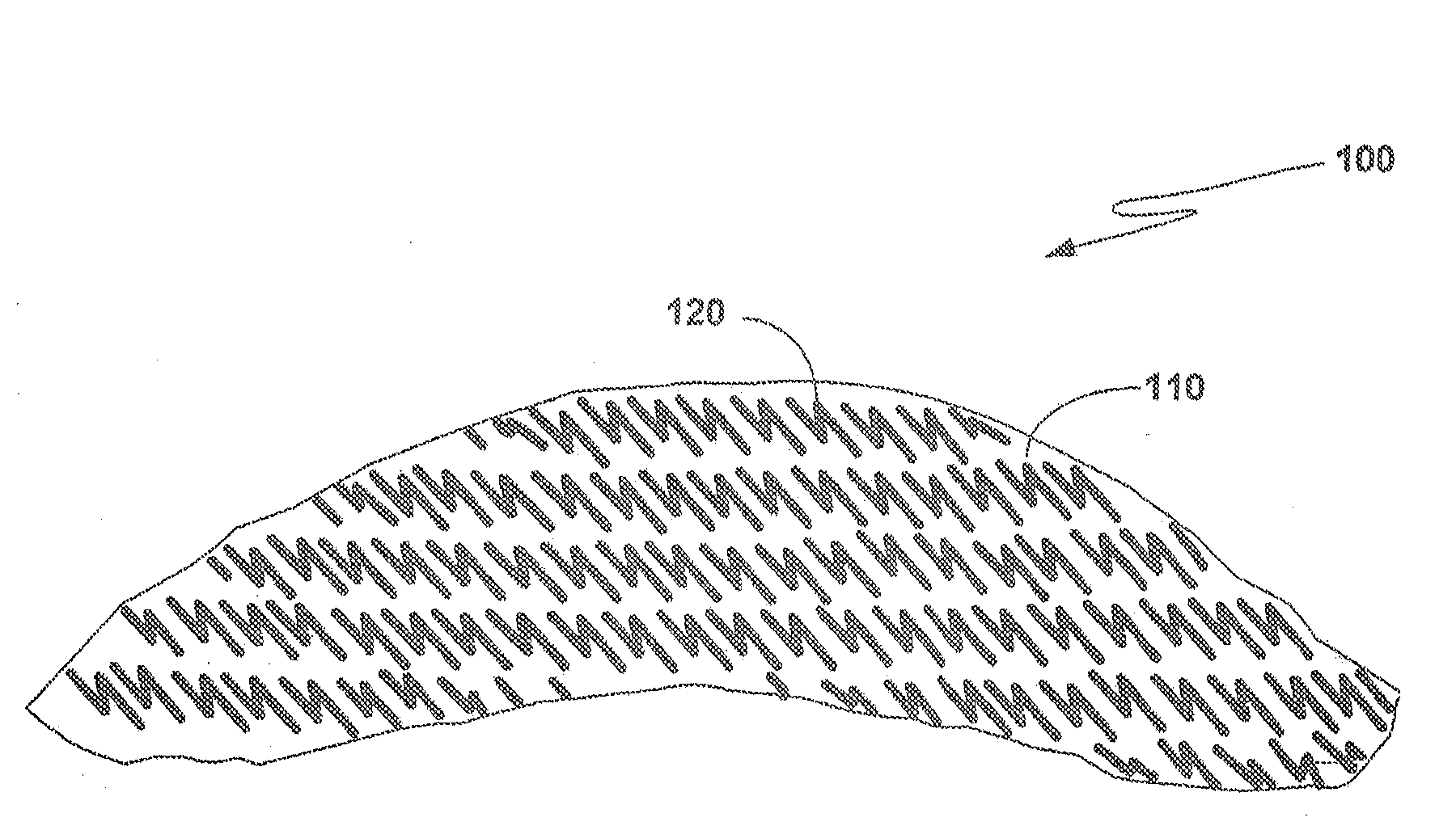 Device and method for treating neuropathy