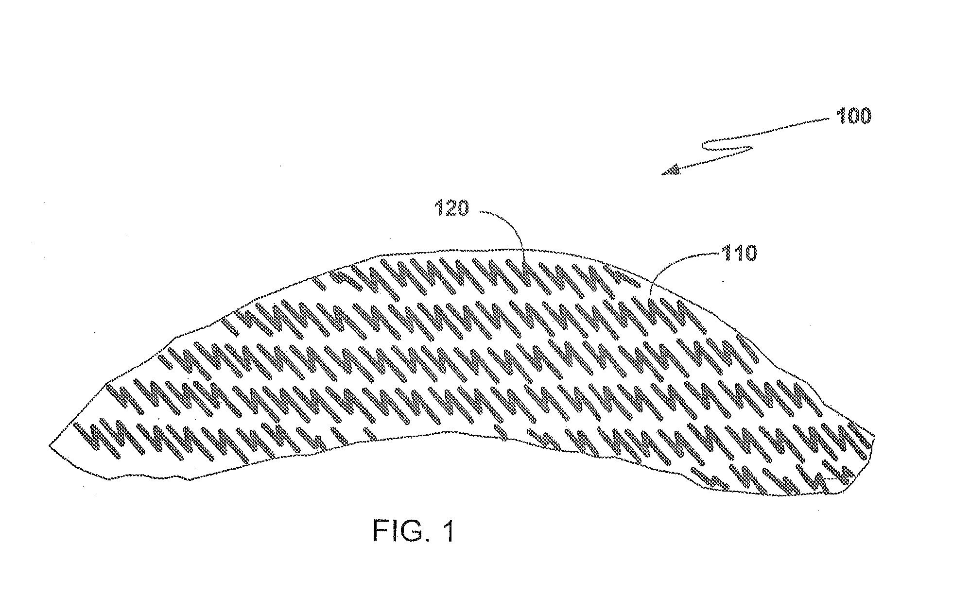 Device and method for treating neuropathy