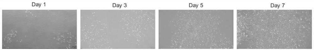 Muscle stem cell separation and extraction and novel hydrolysate culture system and application thereof