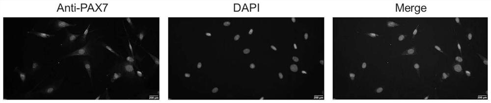 Muscle stem cell separation and extraction and novel hydrolysate culture system and application thereof