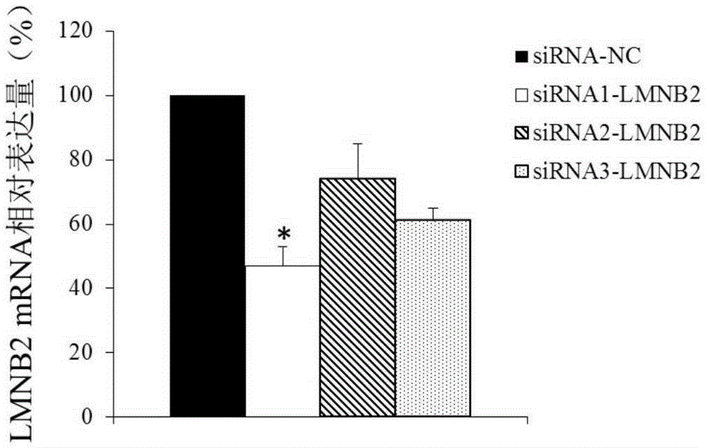 LMNB2 gene and expression product thereof as diagnosing and treating target for nasopharyngeal carcinoma