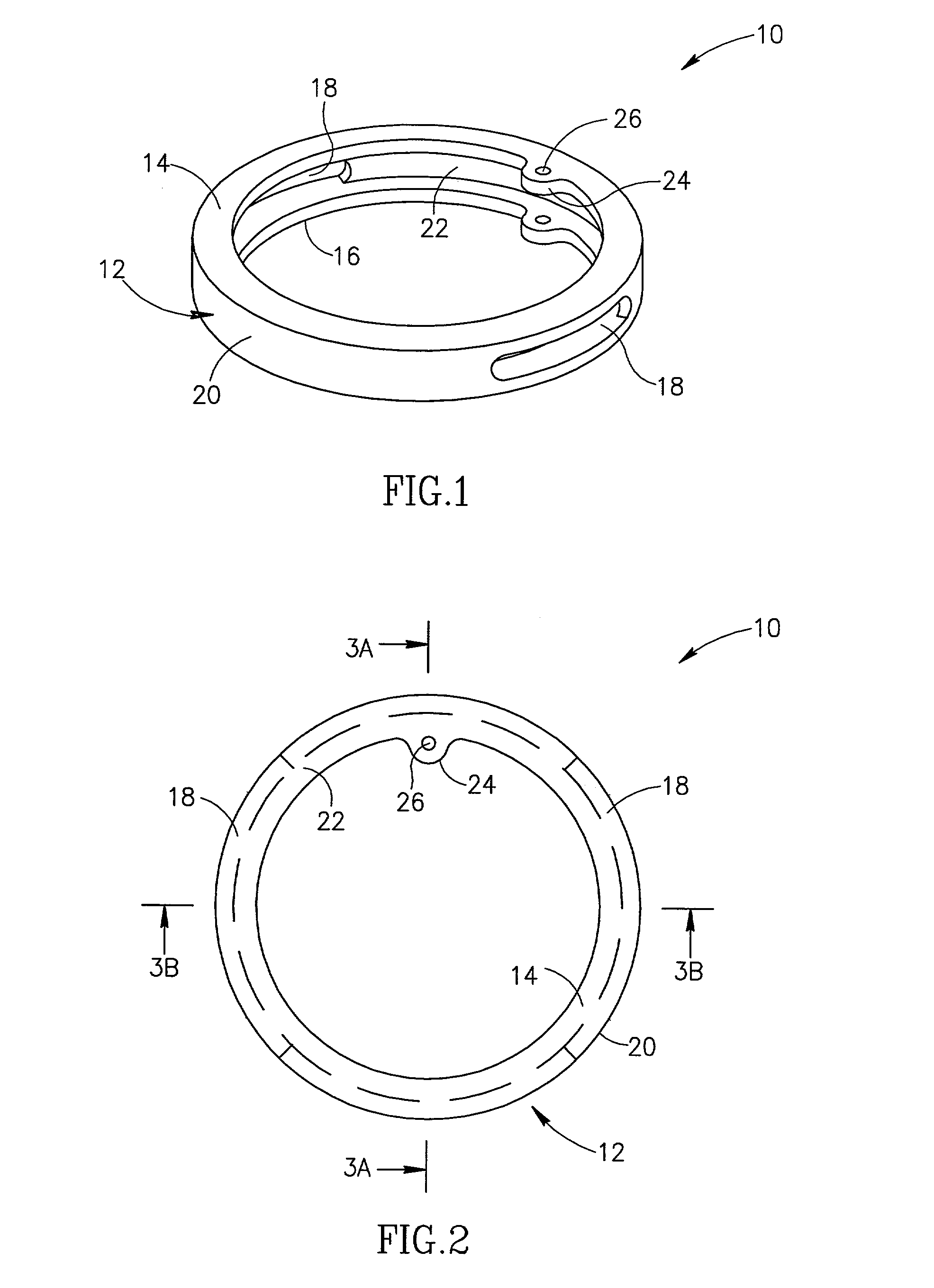 Intraocular ring