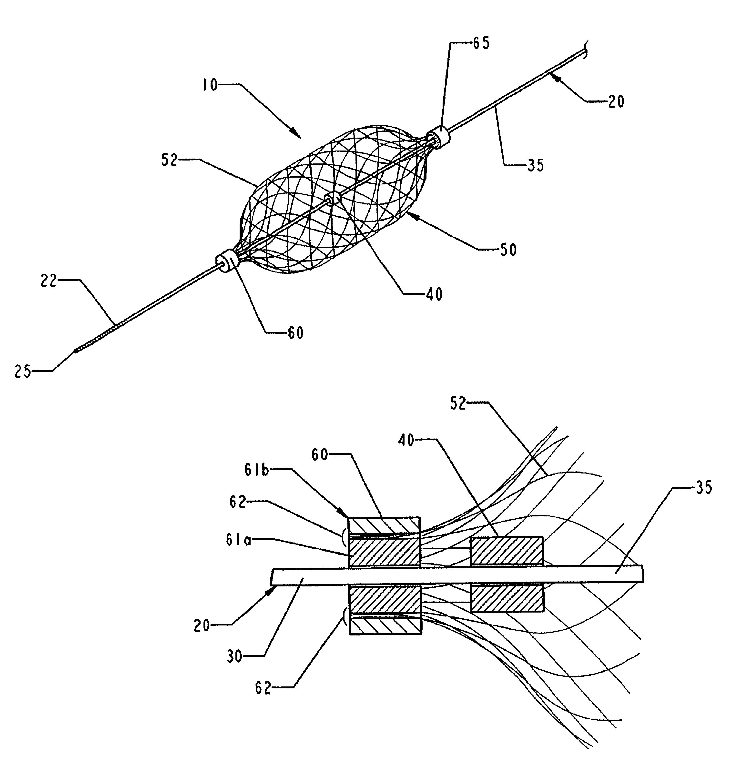 Slideable vascular filter