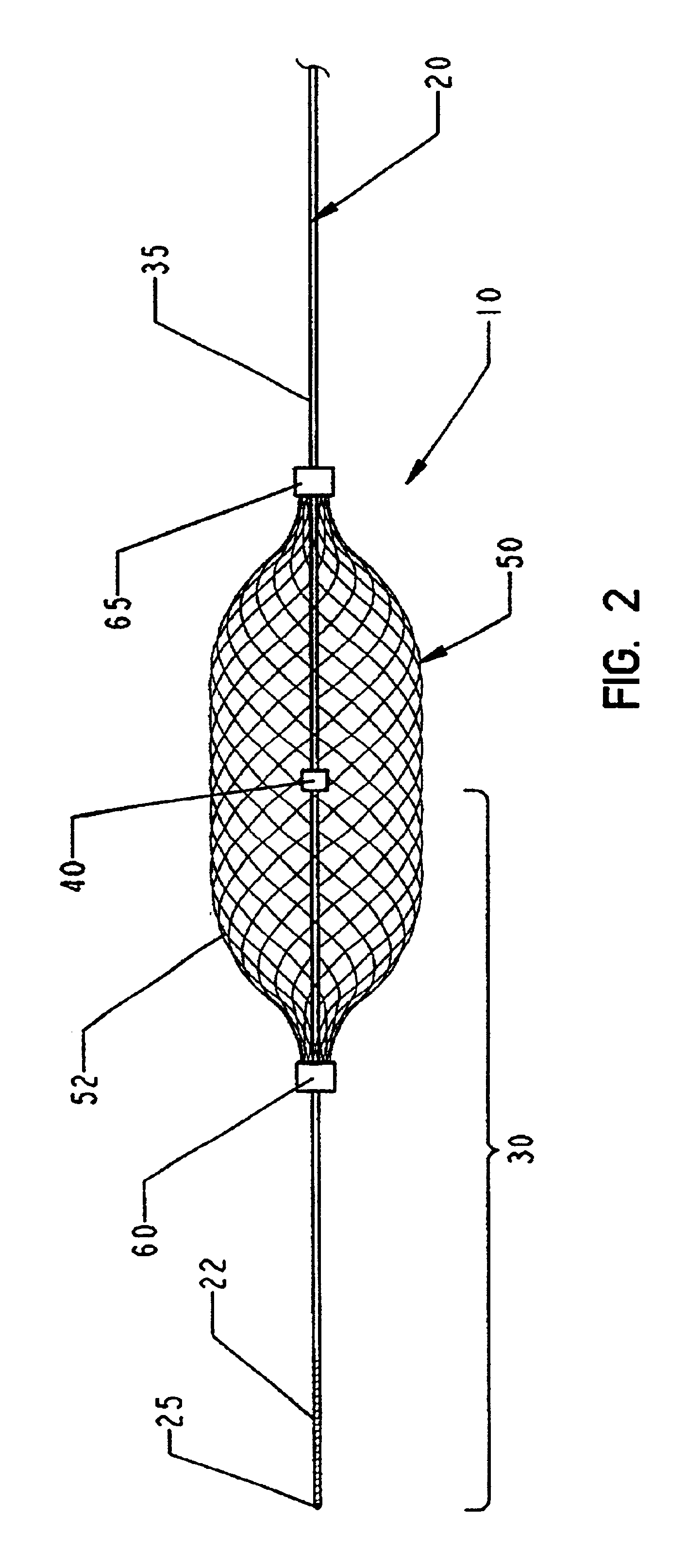 Slideable vascular filter